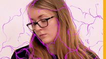 Fibromyalgia: 'Like red hot lava radiating through my body'
