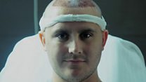 Fighting against my receding hairline