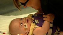 Heart outside body baby set to come home