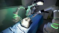 Santé: des robots chirurgiens