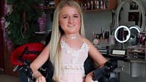 Disabled student wins funds for US dream