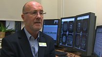 Why catching cancer earlier is so important