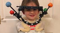 Halo brace boy puts on brave face