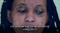 ጠባሳየ ውበቴ ነው