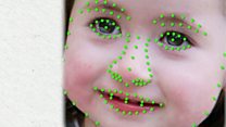 Диагноз по фото: нейросеть распознает генетические болезни