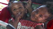 Jumelles siamoises: le choix impossible