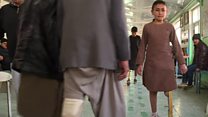 سور صلیب: هر کال لسو زرو معلولو افغانانو ته مصنوعي غړي اچوو