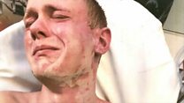 'He watched me burn'