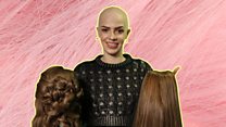 'I lost my hair at one to alopecia'