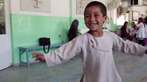 Dancing Afghan amputee boy goes viral