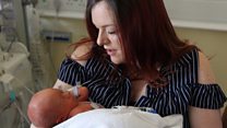 Spina Bifida surgery baby 'a miracle'