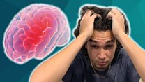 Migraines: More Than A Headache