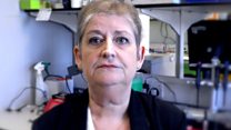 'I had my oesophagus removed on camera'
