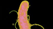Igice cya kabiri ku ndwara ya helicobacter pylori