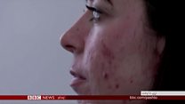 پر مخ دې څه شوي؟