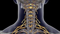 Surgeons reverse hand and arm paralysis