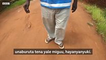 Ugonjwa wa mabusha: 'Mfano wake kama chungwa'