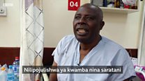 Gharama ya kutibu saratani Kenya