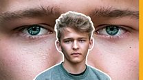 Why do I loose my mental health care when I turn 18?