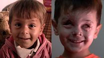 A young face destroyed by war