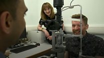 Acid attack victim in pioneering treatment