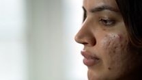 In search of perfect skin