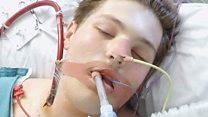 'I nearly lost my life' after vaping