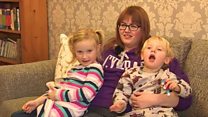 Coes prosthetig 'am wneud gwahaniaeth enfawr'