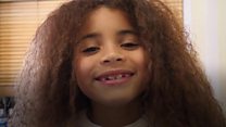 Farouk James The Boy With Very Long Hair Bbc News