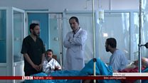 د میلیونونو کسانو لپاره ۳۰ زره روغتیا پالان