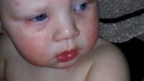 'If he touches that birthday cake, he'll die'