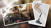 Ex-soldier amputee: 'I can feel everything now'