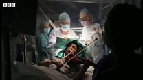 脳の手術中にバイオリンを演奏、患者の左手を守るため　英病院