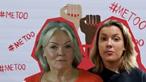 Life after #MeToo: My colleague bit me on the neck