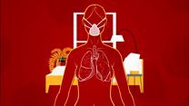 How long it takes to recover from coronavirus