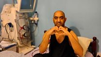 'I'm waiting for my third kidney transplant'