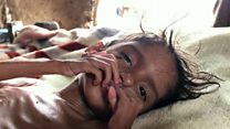 Five years of hunger, five years of war