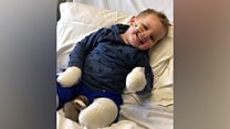 ‘The naughty crocodile took my leg’