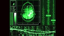 Coma Patient Scan