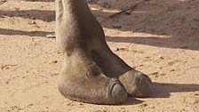 A camel toe