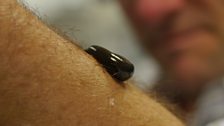 Bitten by a leech