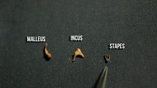 The ossicles in the ear are the smallest in the human body and have the highest mineral content of any bone