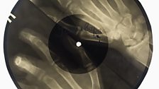 X-Ray Audio images