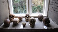 Damien Hirst, Skulls display