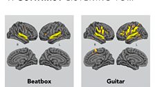 A guitarist's brain lights up...