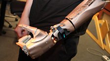 James Young's futuristic prosthetic arm