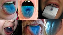 Are you a supertaster?