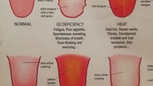 Chinese Medicine Chart