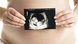 Pregnant women warned on taking paracetamol 