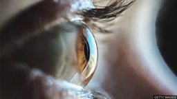Algae proteins partially restore man’s sight 藻类蛋白帮助男子恢复部分视力